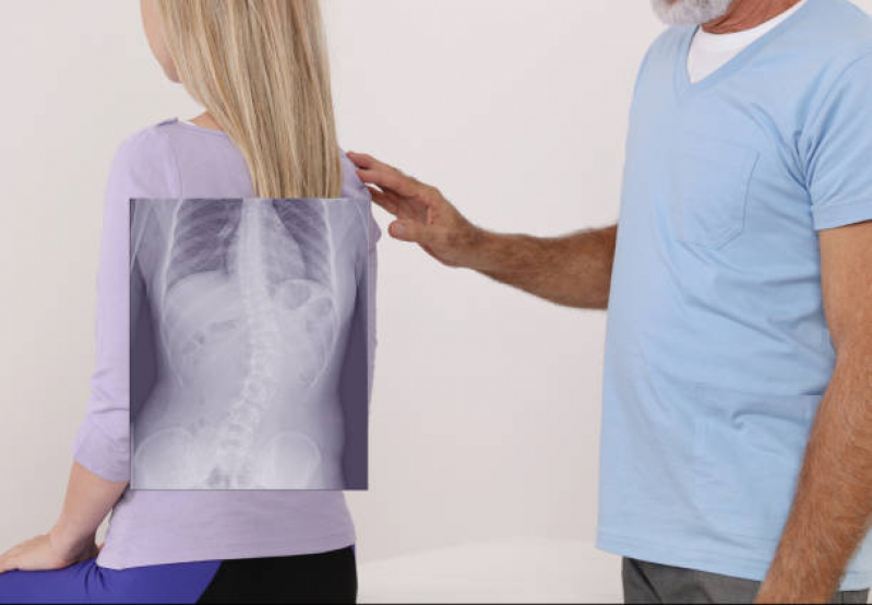 Procedimento de Osteopatia Lombar Rafard - Osteopatia para Escoliose
